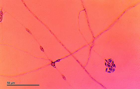 Imagem de Pythium N. Pringsheim 1858