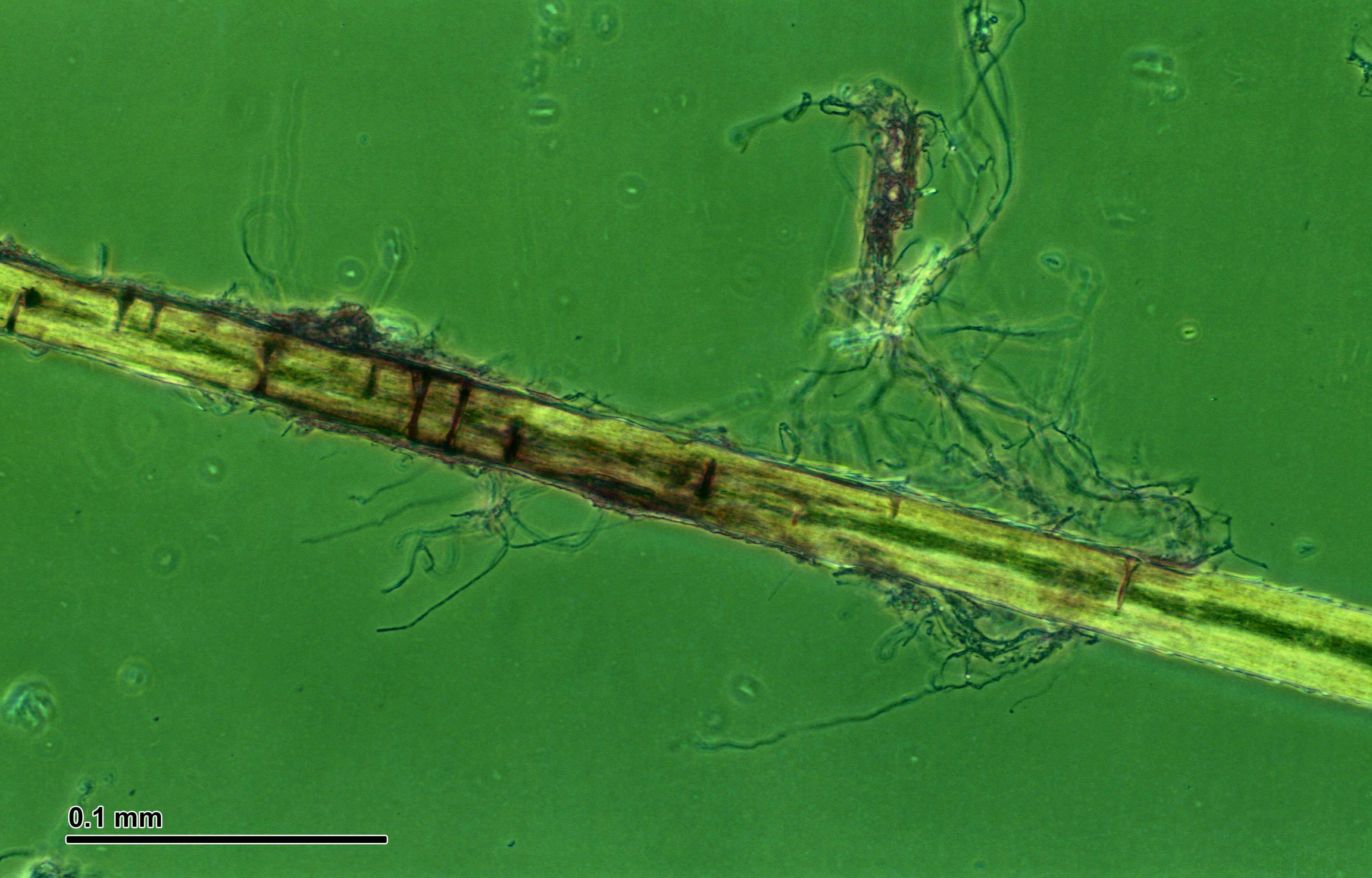 Sivun Trichophyton mentagrophytes (C. P. Robin) Sabour. 1895 kuva