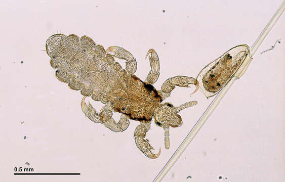 Image of head louse