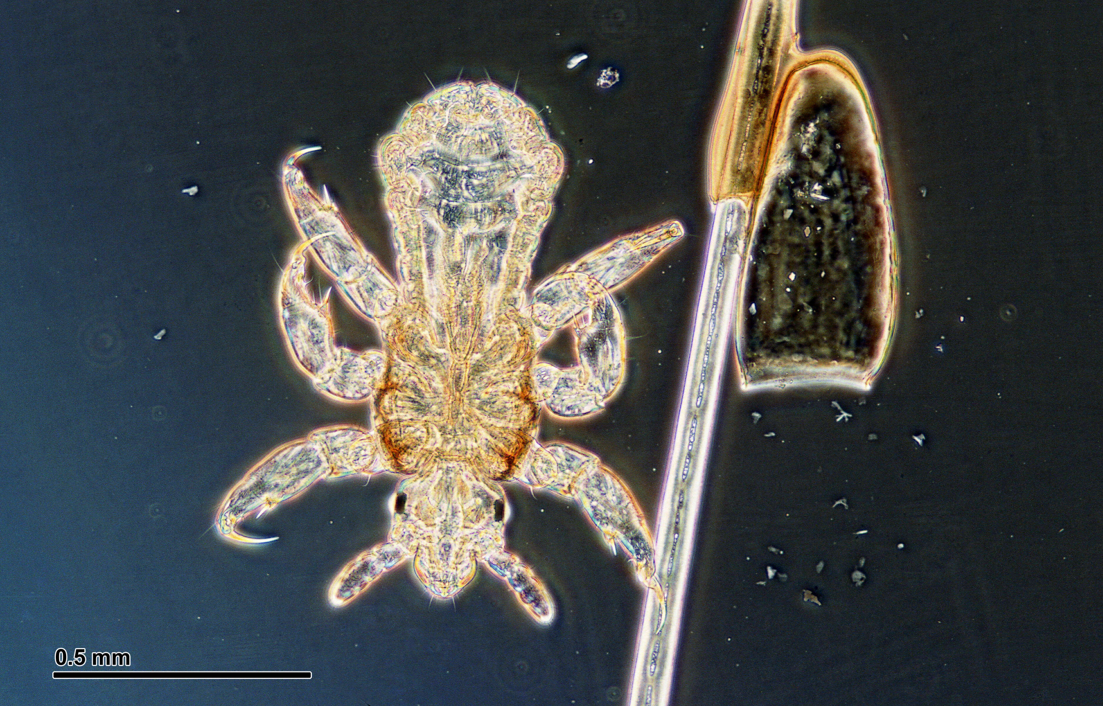Image of pubic lice