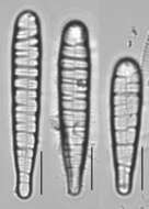 Meridion circulare (Greville) C. Agardh 1831 resmi