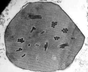Image of Baculovirus