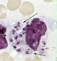 Image of Leishmania tropica