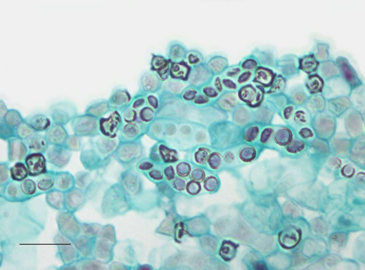 Image of Schizosaccharomyces