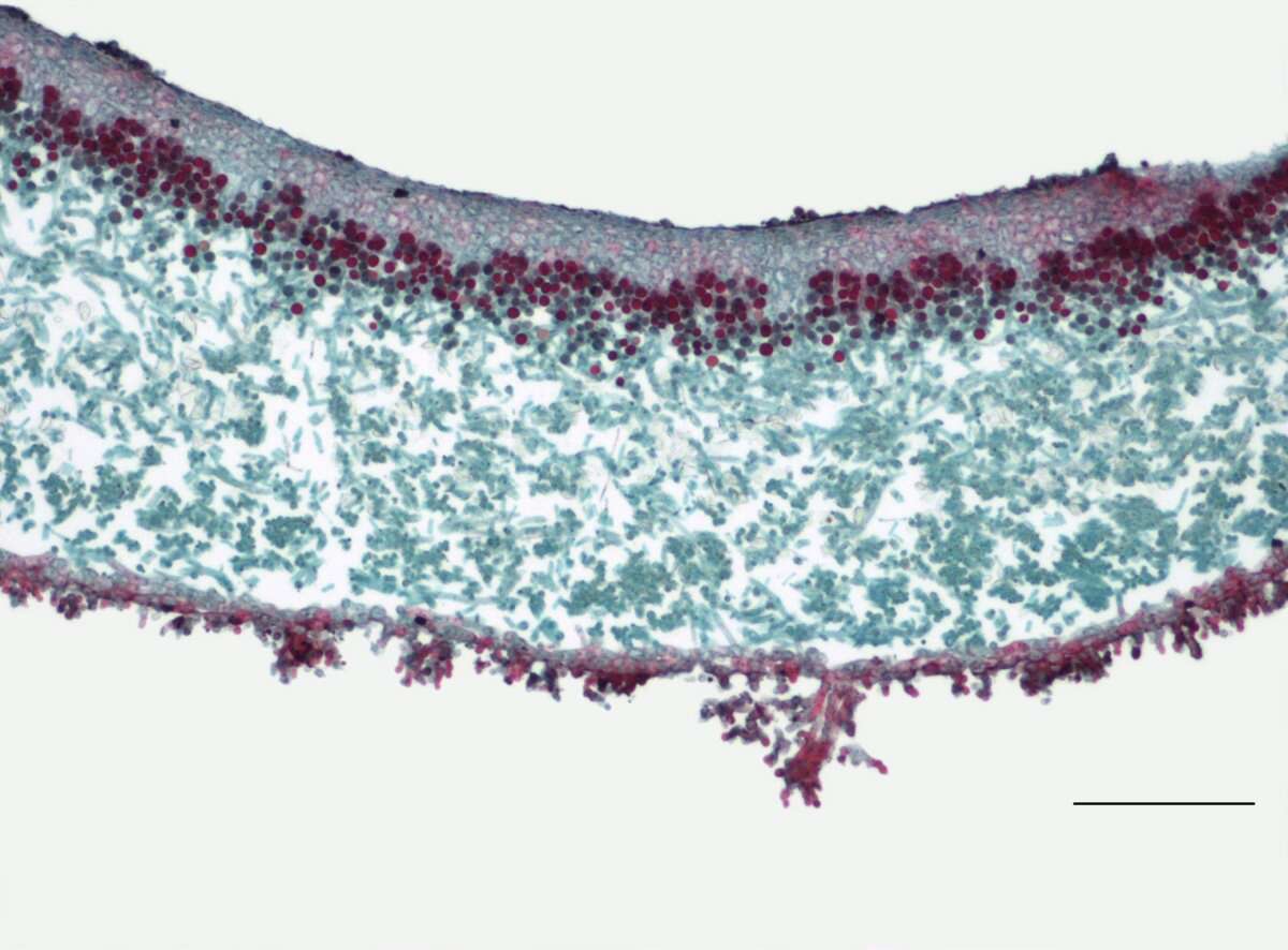 Image of rosette lichen