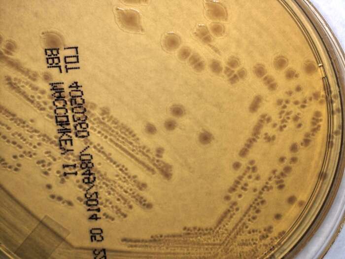 Image of Yersinia pseudotuberculosis