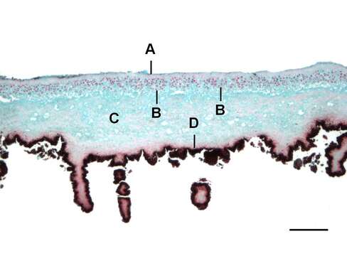 Image of navel lichen