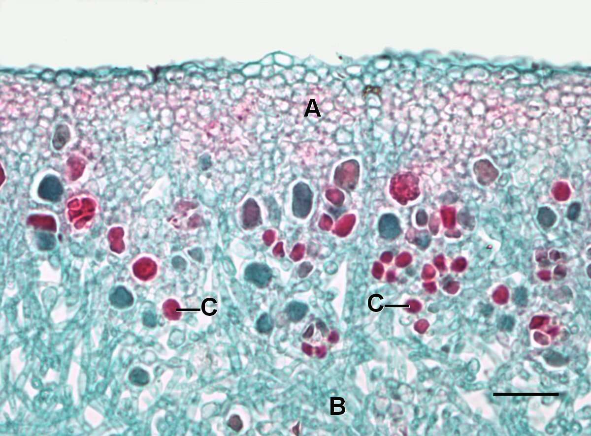 Image of navel lichen