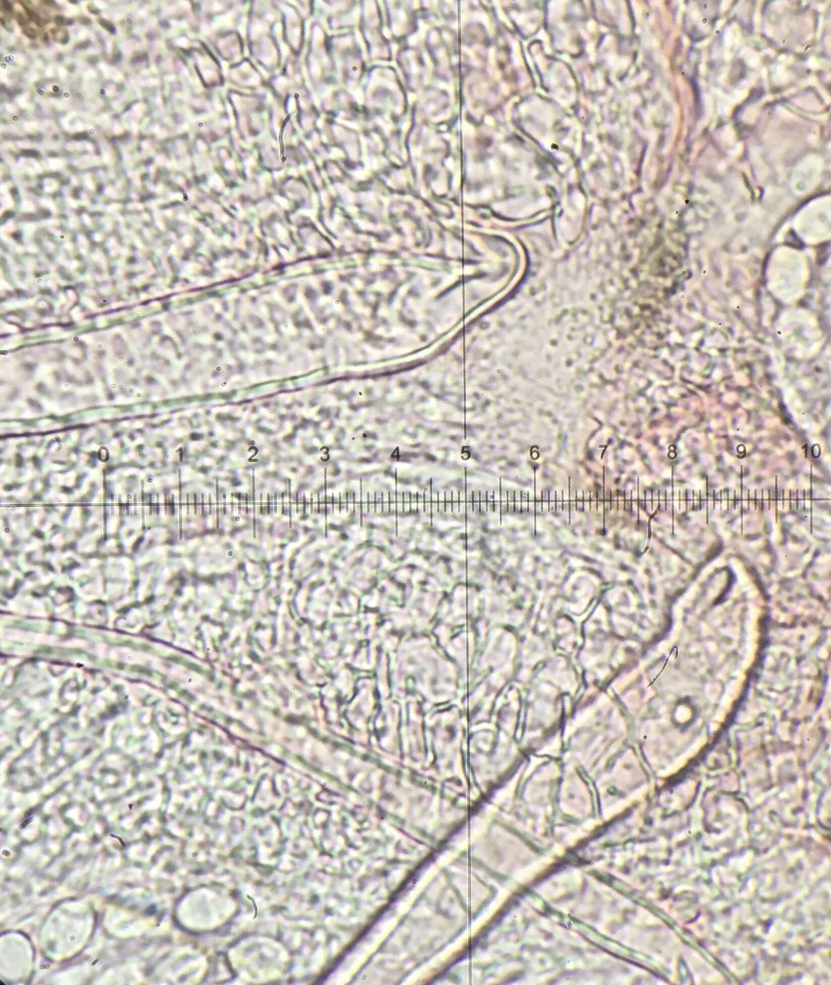 Image de Lasiobolus microsporus J. L. Bezerra & Kimbr. 1975