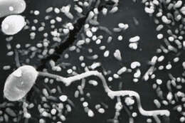 Image de Microsporidies