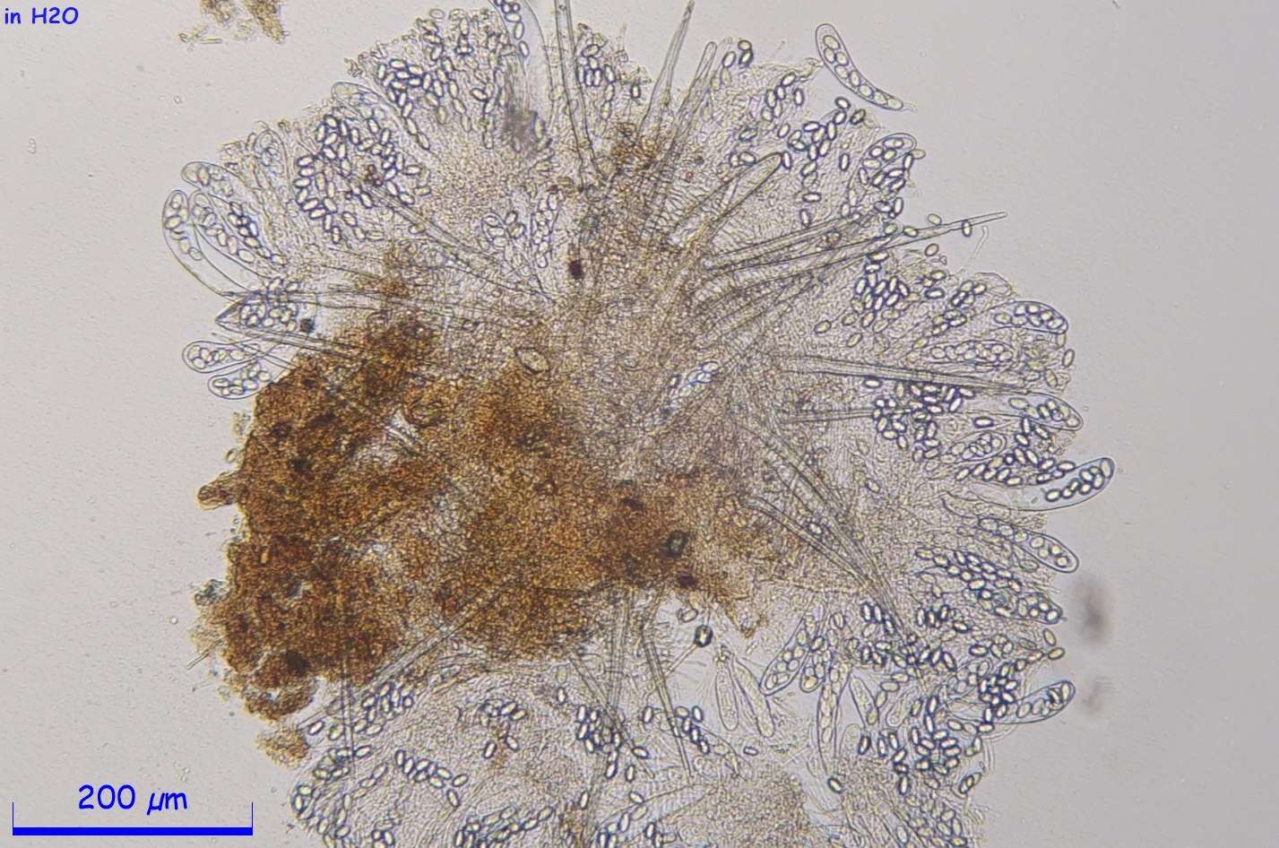 Imagem de Lasiobolus intermedius J. L. Bezerra & Kimbr. 1975