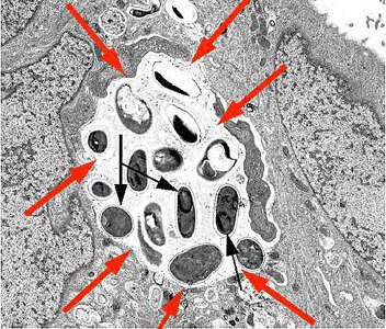 Image of microsporidian parasites