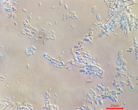 Imagem de Aureobasidium subglaciale (Zalar, de Hoog & Gunde-Cim.) Zalar, Gostincar & Gunde-Cim. 2014