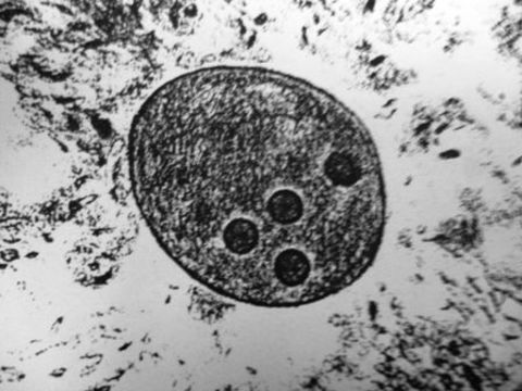 Image of <i>Entamoeba histolytica</i>