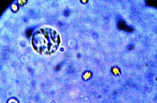 Image of <i>Entamoeba histolytica</i>