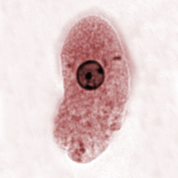 Image of <i>Entamoeba histolytica</i>
