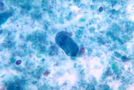 Image of <i>Entamoeba histolytica</i>