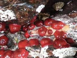 Image of Beadlet anemone