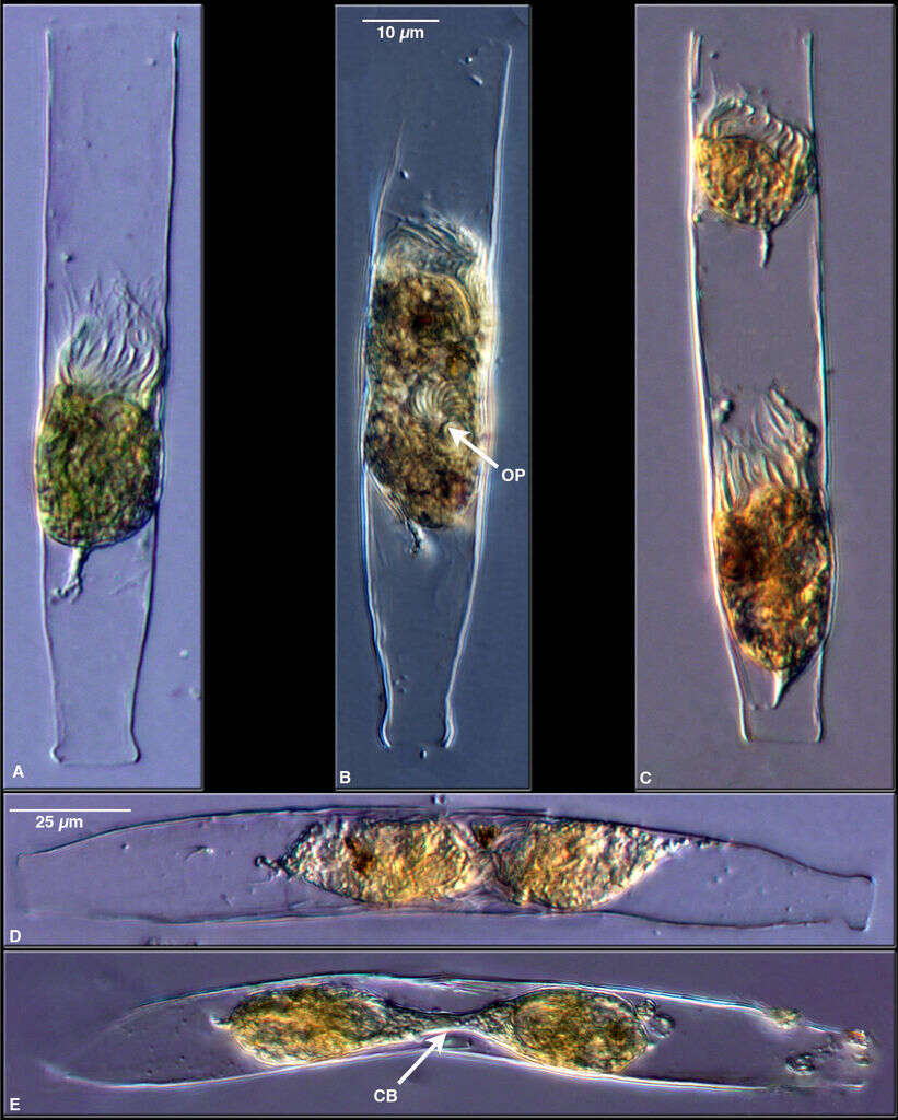 Image of ciliates