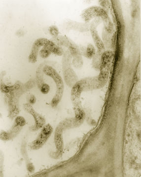 Image of Spiroplasma