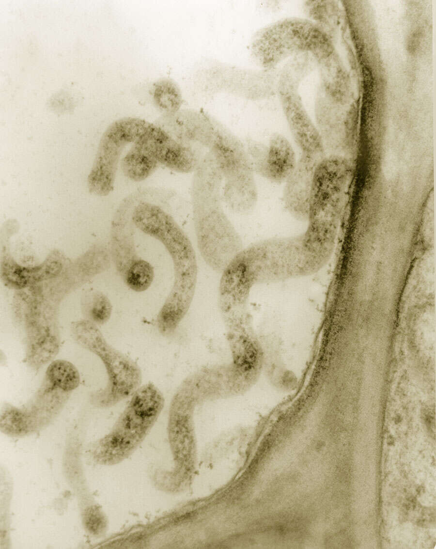 Image of Spiroplasma kunkelii