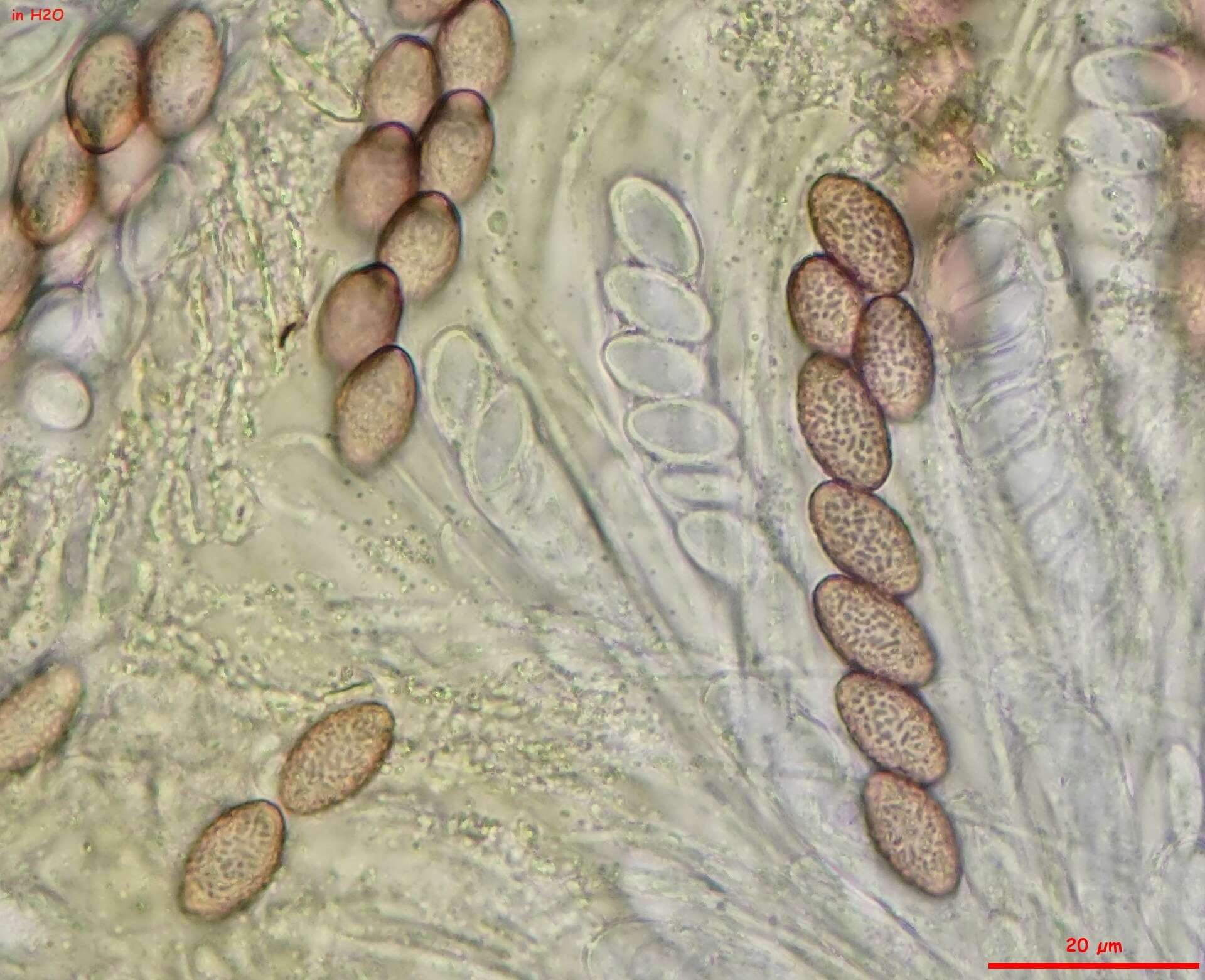 Image of Ascobolus lineolatus Brumm. 1967