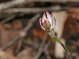 Image of White fingers