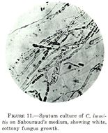 Image of <i>Coccidioides immitis</i> G. W. Stiles 1896