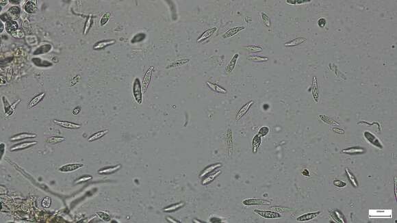 Image de Sirobasidium magnum Boedijn 1934