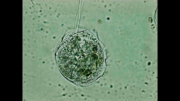 Image of Vorticella campanula