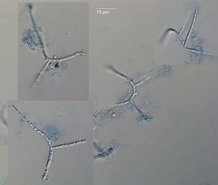 Imagem de Taeniospora gracilis Marvanová 1977