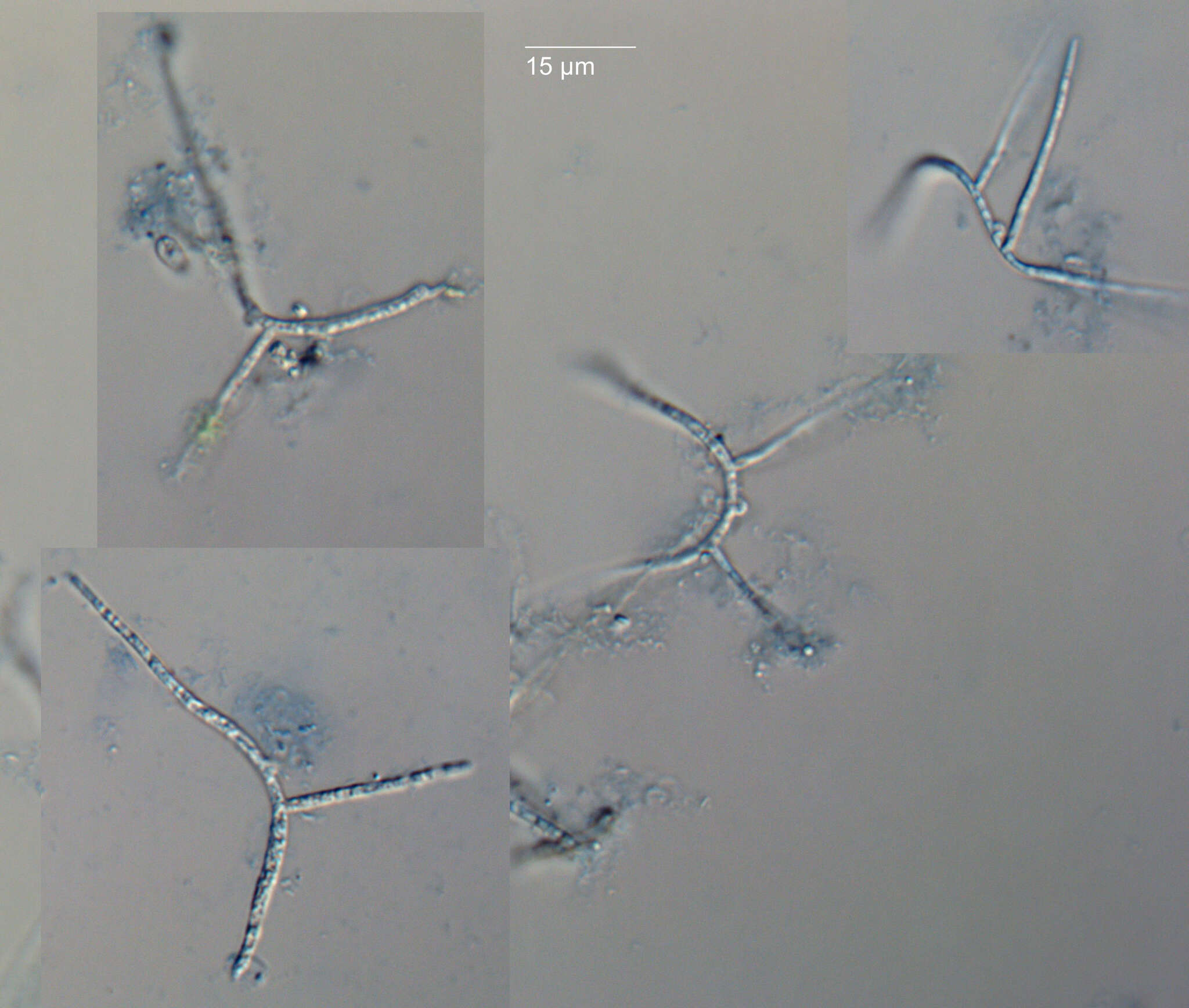 Image de Taeniospora gracilis Marvanová 1977