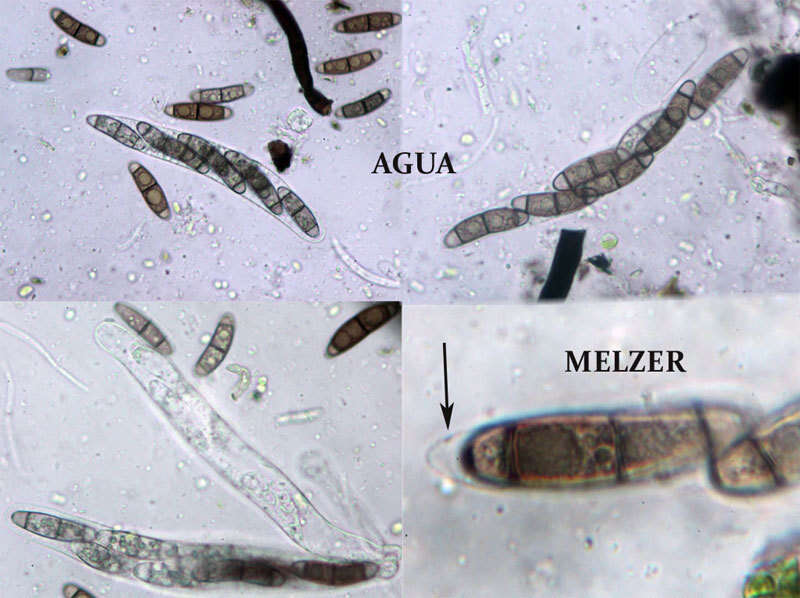 Imagem de Chaetosphaerella fusca (Fuckel) E. Müll. & C. Booth 1972