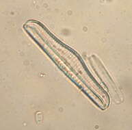 Image of <i>Epithemia gibba</i> Kützing