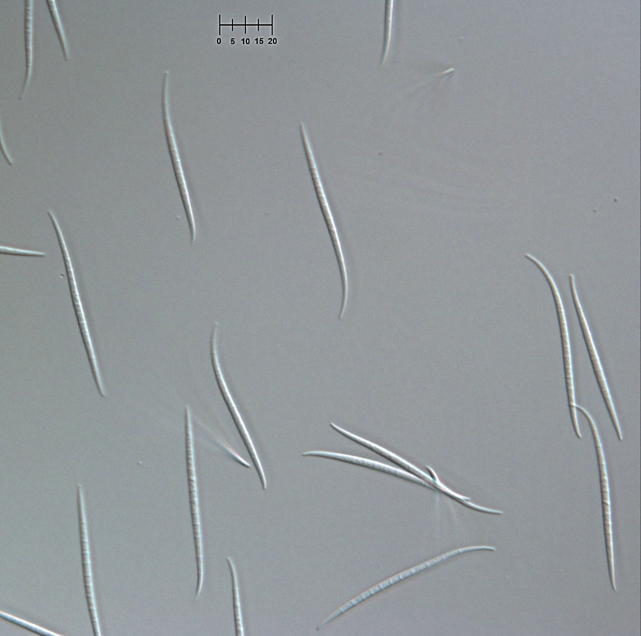 Image of Morrisographium ulmicola (Ellis & Everh.) Illman & G. P. White 1985