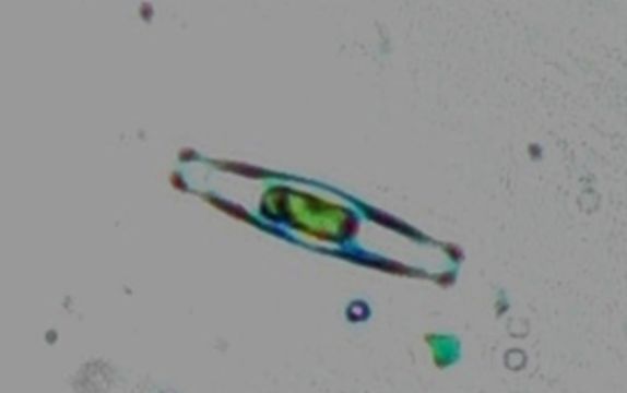 Image of Navicula