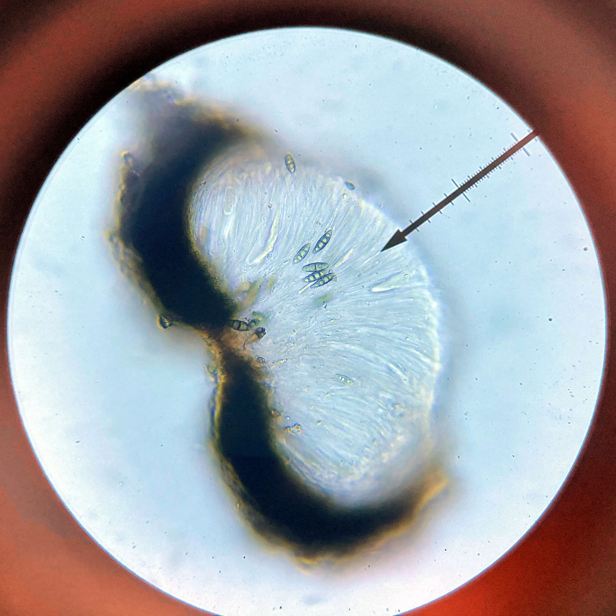 Image of <i>Eopyrenula intermedia</i>