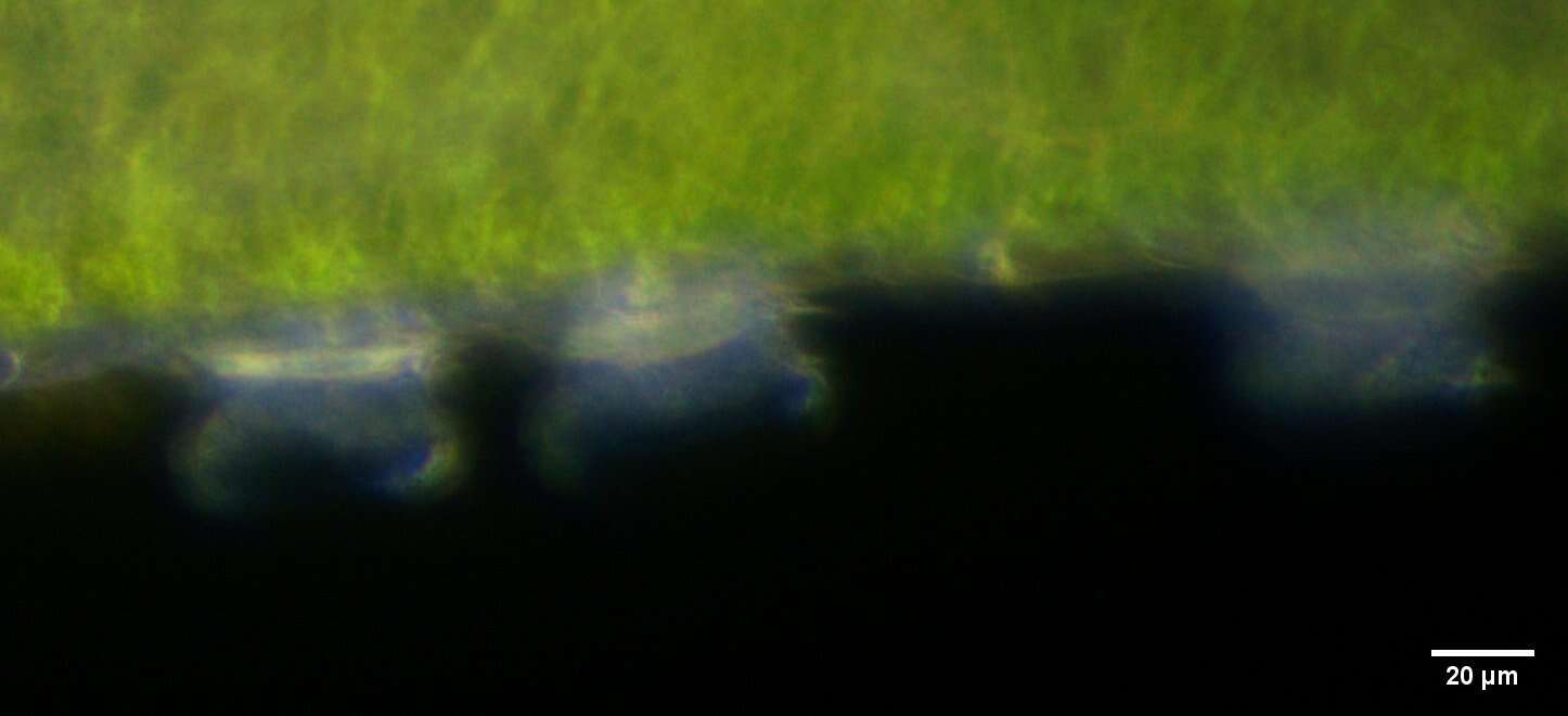 Image of Trichodina pediculus