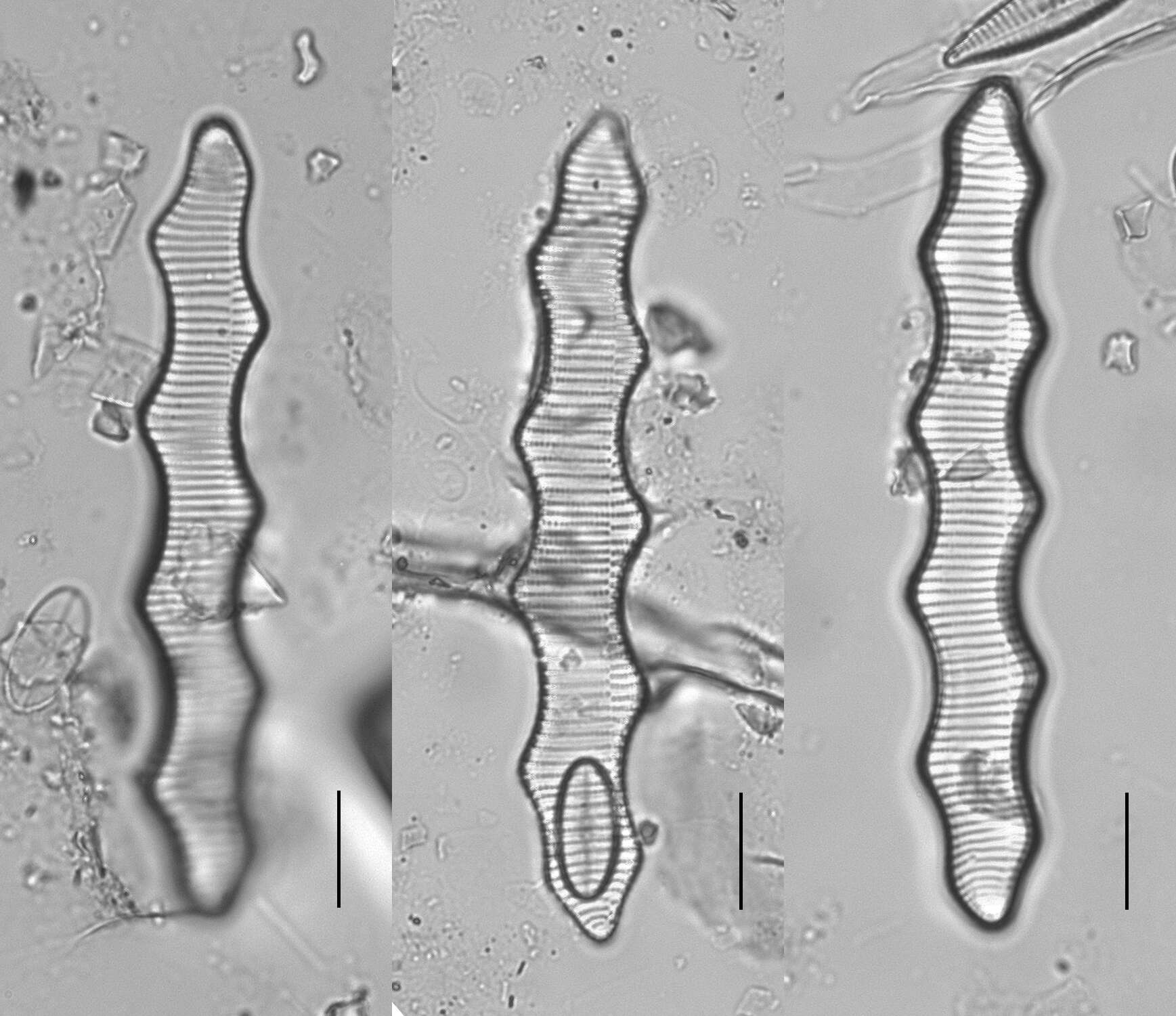 Image de Amphicampa mirabilis Ehrenberg ex Ralfs 1861