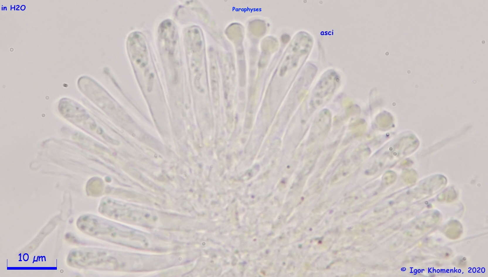 Image of Orbilia xanthoflexa