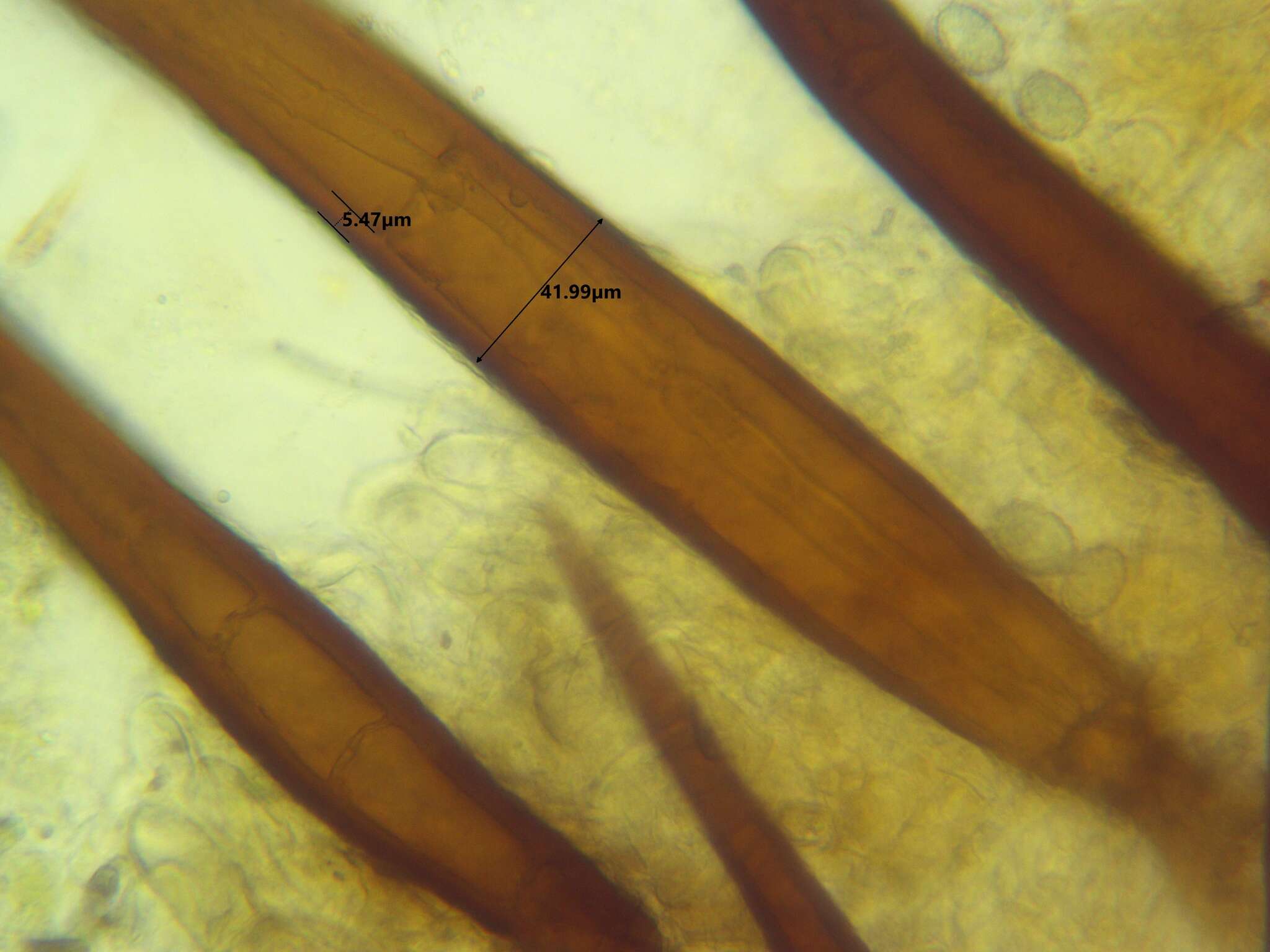 Image of Scutellinia pennsylvanica (Seaver) Denison 1961