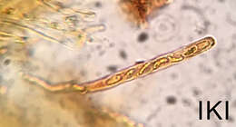 Image of Orbilia carpoboloides (P. Crouan & H. Crouan) Baral 1994
