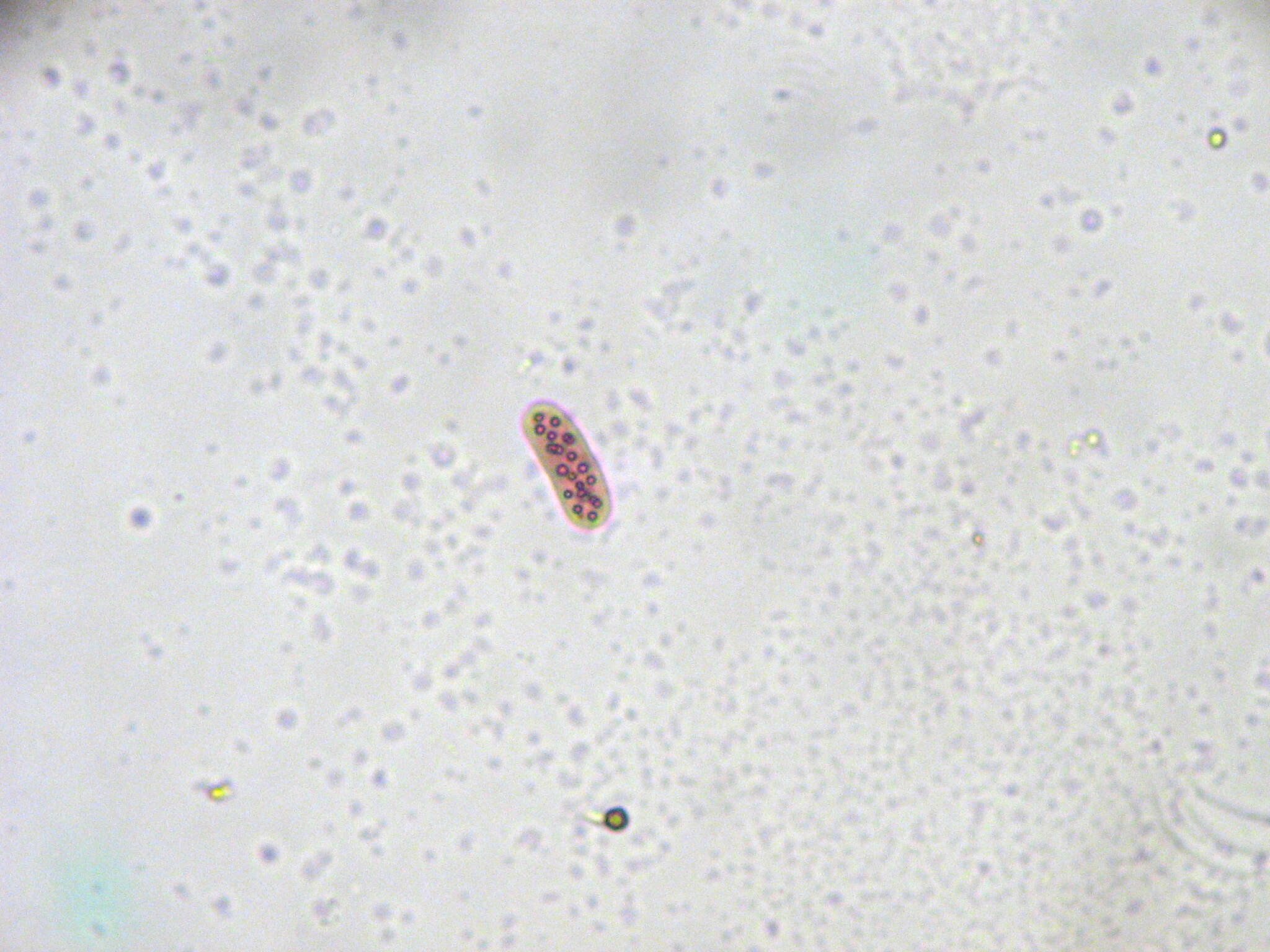 Image de Chromatium okenii