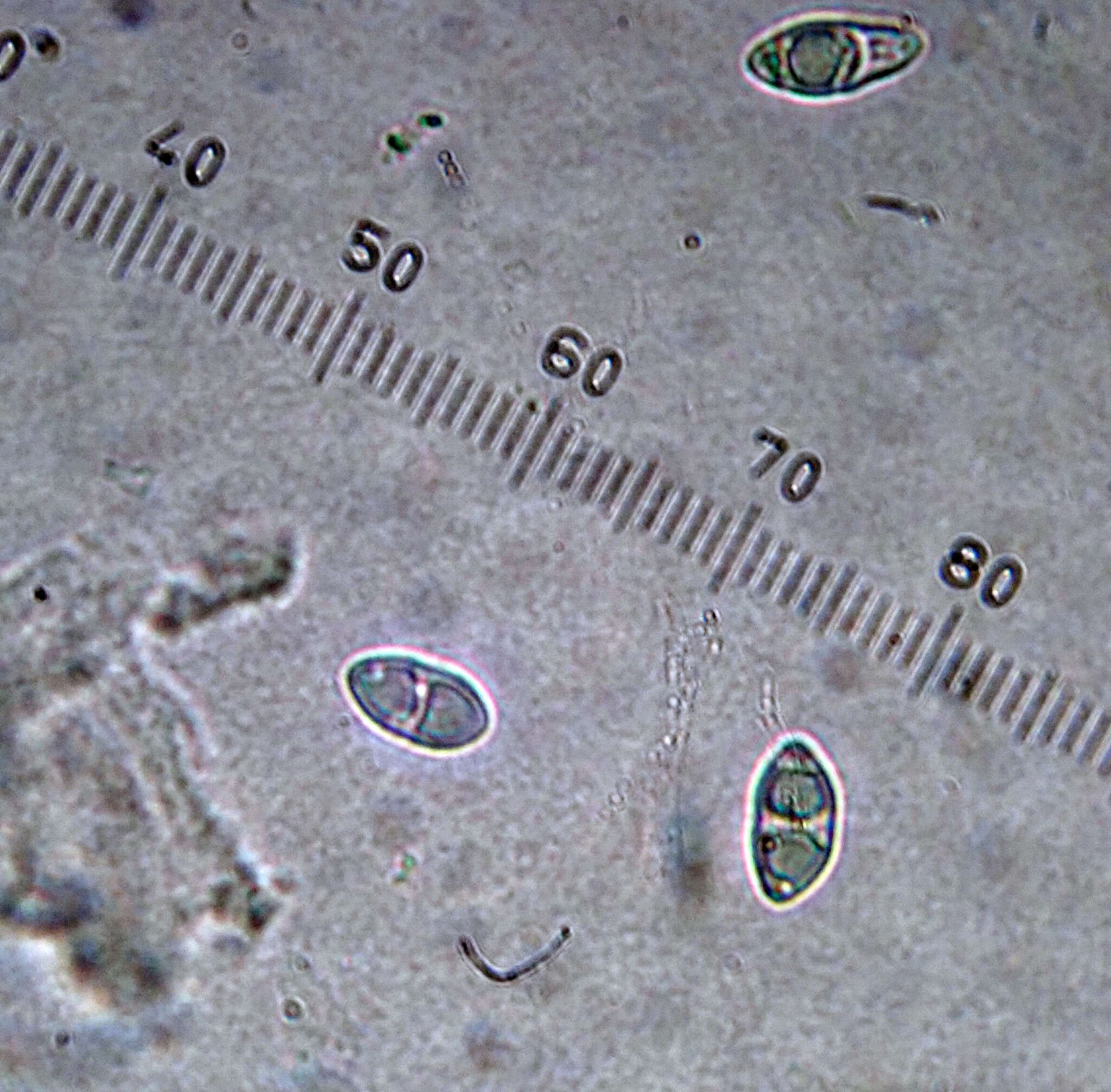 Image of Megalaria melanotropa (Nyl.) D. J. Galloway