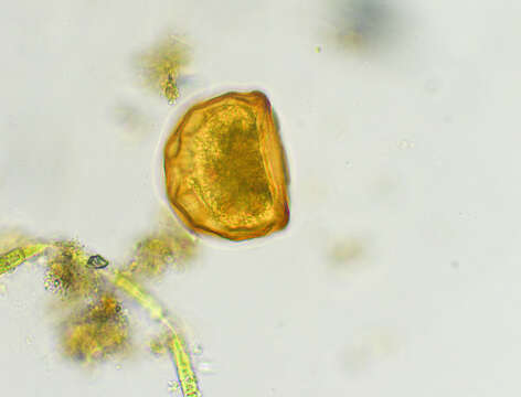 Image of Arcella gibbosa