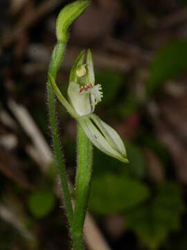 Image of White fingers