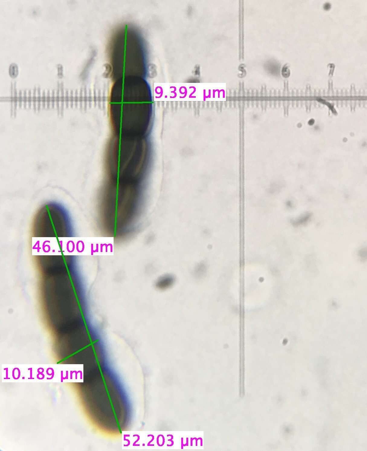 Image of Sporormiella capybarae (Speg.) S. I. Ahmed & Cain 1972