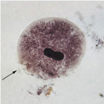 Image of <i>Balantidium coli</i> (Malmsten 1857) Stein 1863