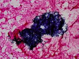Image of Bacillus thuringiensis