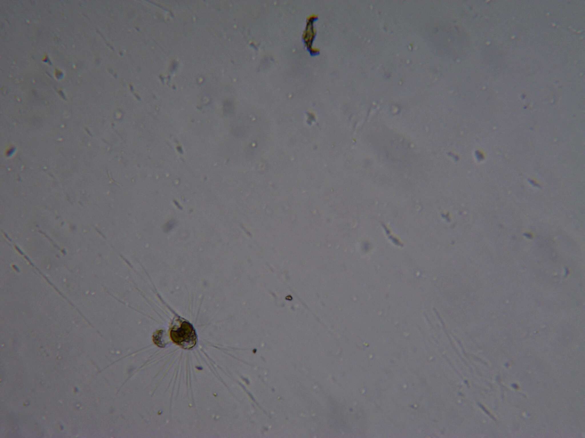 Image of Asterionella